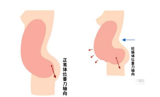 盆底恢復(fù)是否可以使用儀器？