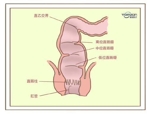 盆底康復(fù)治療儀對產(chǎn)后便秘有哪些幫助？