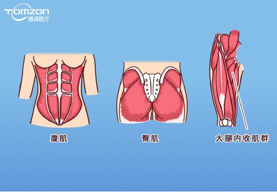 凱格爾運動該怎么做？盆底肌修復(fù)儀器效果會更好嗎？