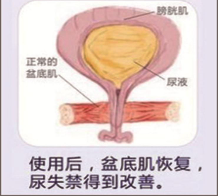 社交癌