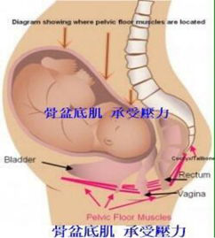 盆底康復(fù)治療