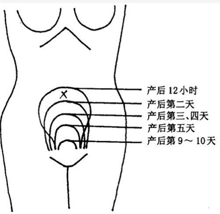 產(chǎn)后康復(fù)